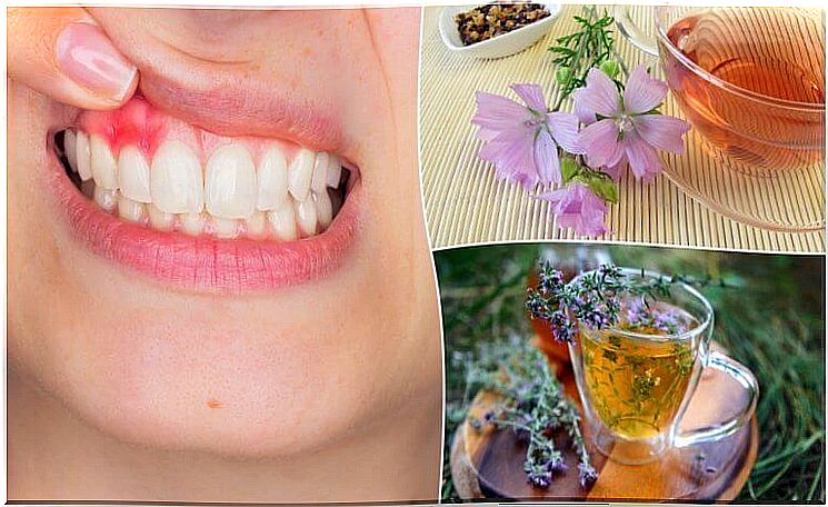 5 natural remedies for gingivitis