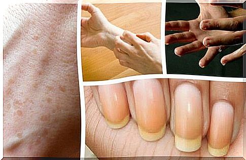 9 things your hands tell you about your health