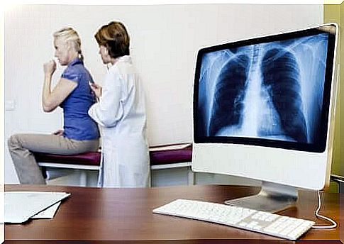 Asbestosis or asbestos lung: signs and symptoms