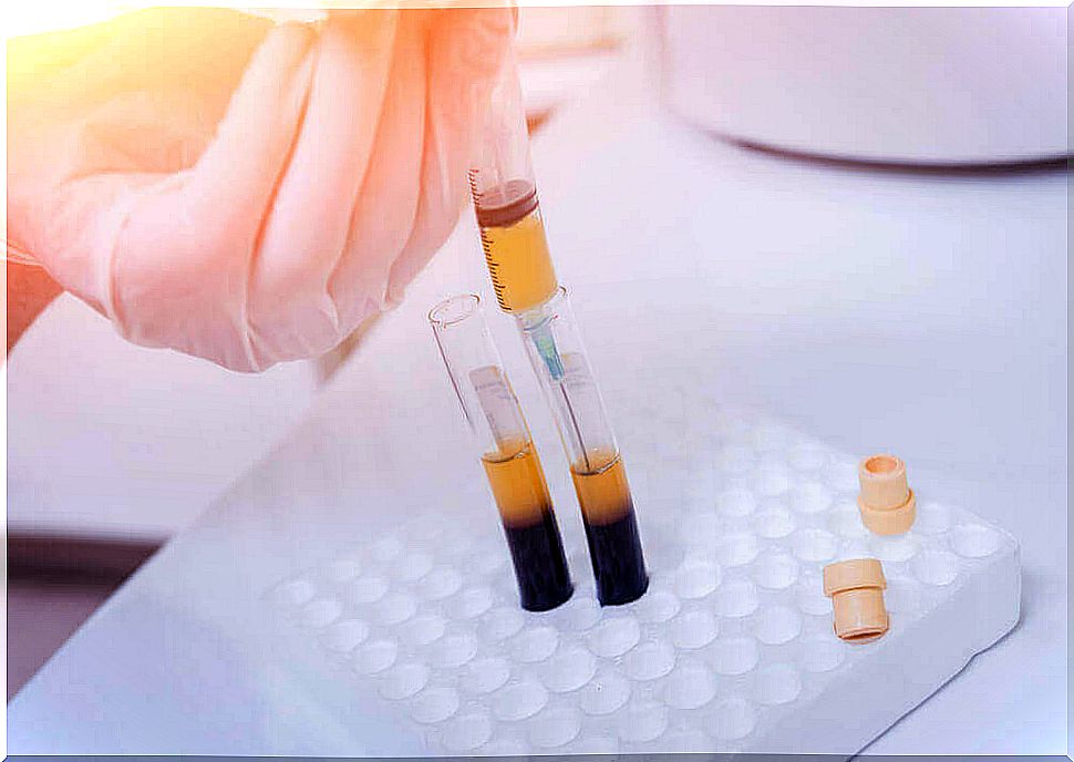 Blood plasma transfusion