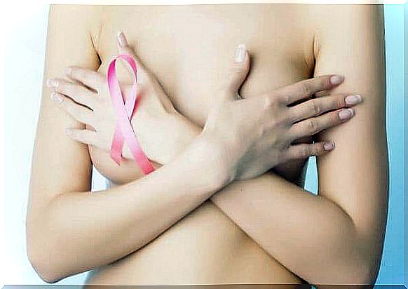 Breast cancer 