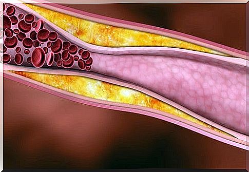 Healthy juices for high cholesterol levels