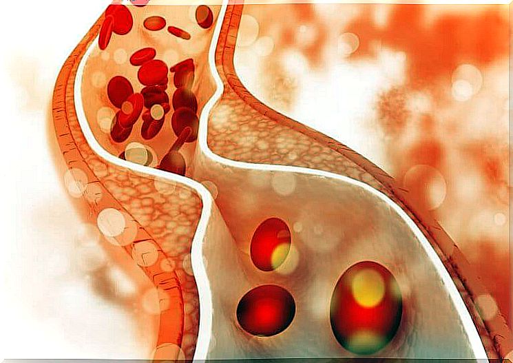 Cholesterol levels