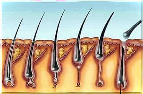 Interesting facts about multiple pilomatrixomas