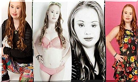 Model with Down Syndrome: Triumph in New York