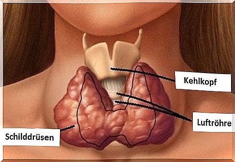 Natural Hypothyroidism Treatment