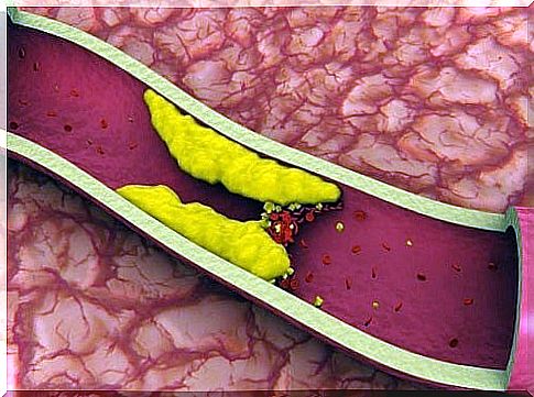 Lower high cholesterol naturally