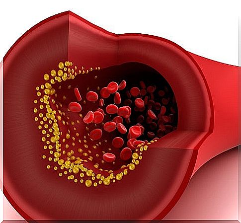 Prevention of high blood triglycerides