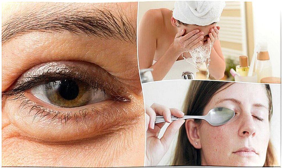 Puffiness under the eyes: 5 tips