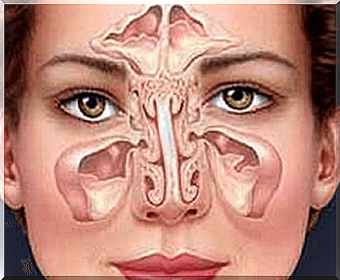 Sinus infection: origin, symptoms and diagnosis