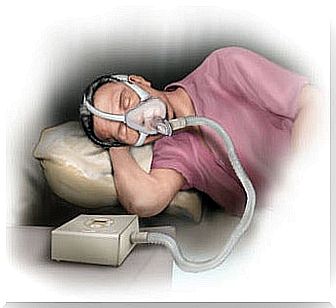 sleep apnea