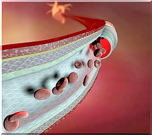 Swollen ankles as a sign of various diseases: weakened blood vessels