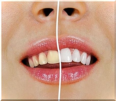 Teeth whitening with natural products