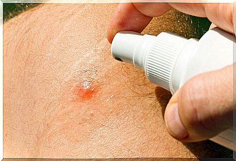 The best homemade insect repellants