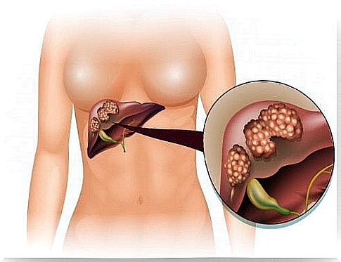 Activated charcoal and the liver