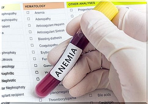 anemia